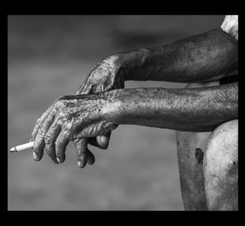 La cigarette et les problèmes de peau : arrêter de fumer par hypnose avant d'avoir des soucis de santé